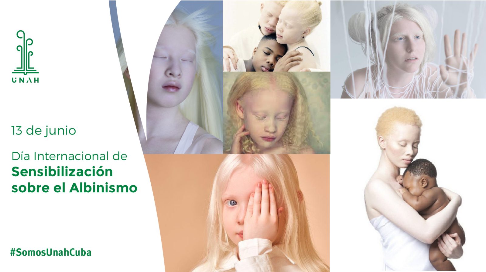 Día Internacional de la sensibilización sobre el albinismo